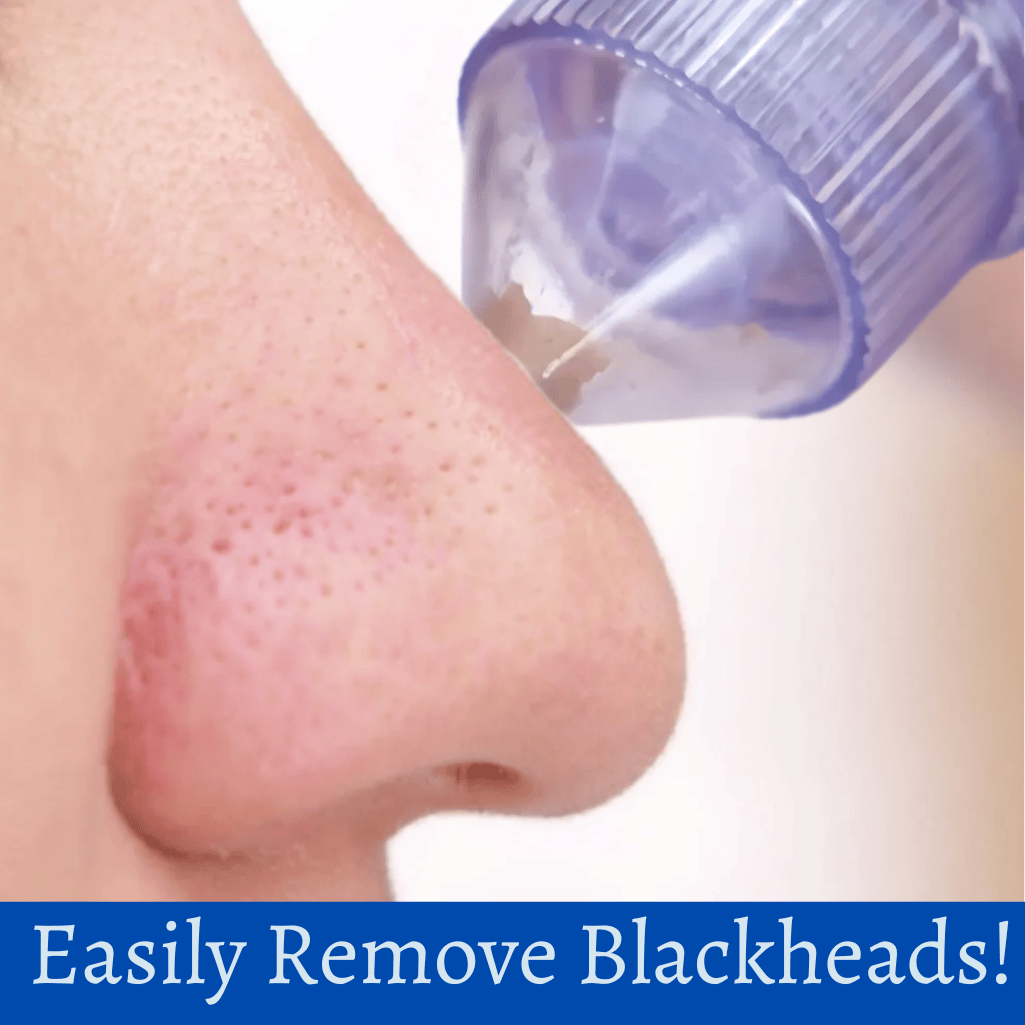 Blackhead Vacuum Remover Device Deep Pore Cleaner
